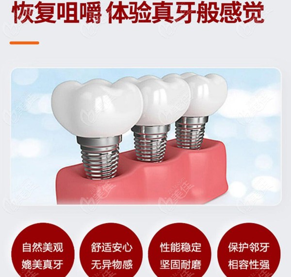 北京西城区做种植牙比较好的牙科医院排名