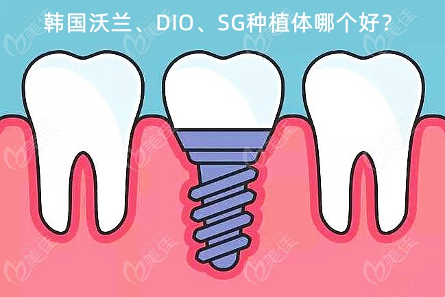 韩国沃兰、DIO、SG种植体对比
