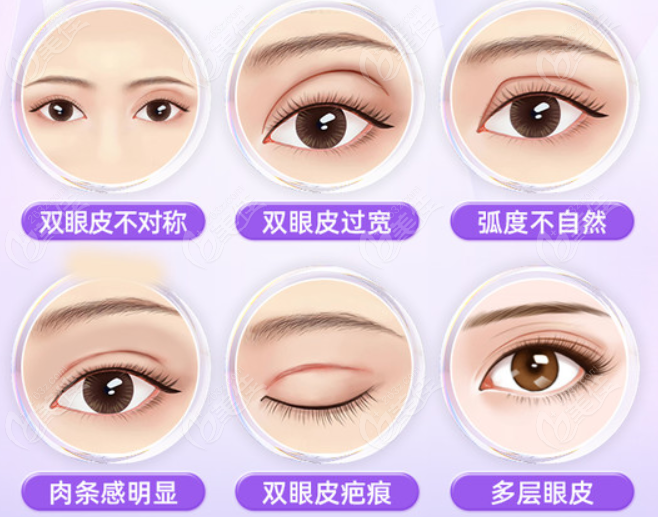 贛州雙眼皮修復哪家醫(yī)院好