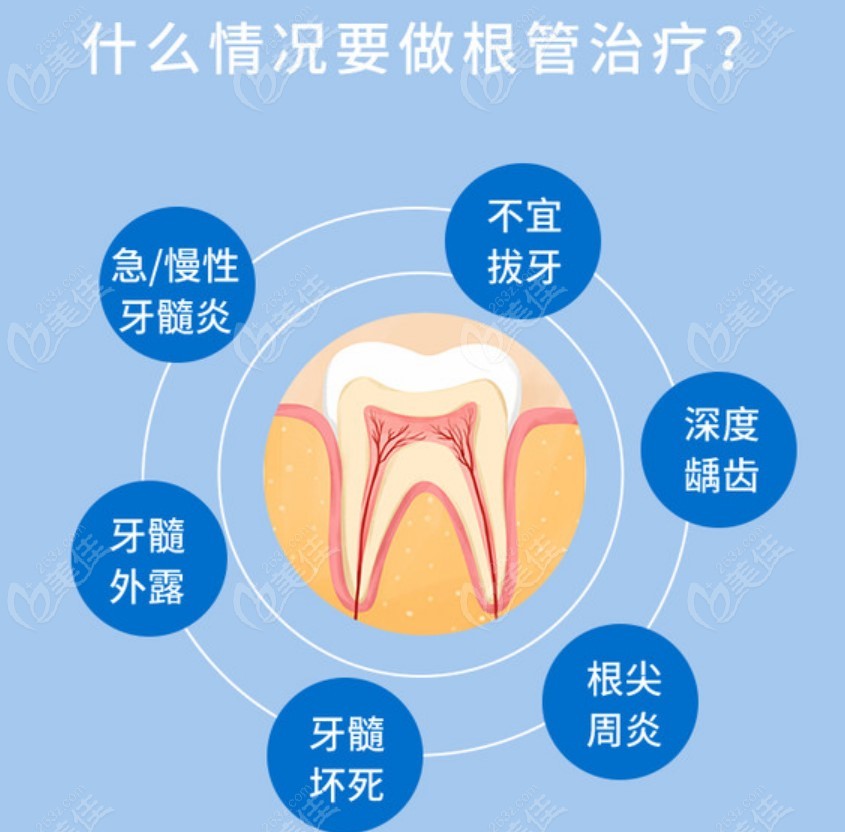 南宁哪里做根管治疗便宜又好