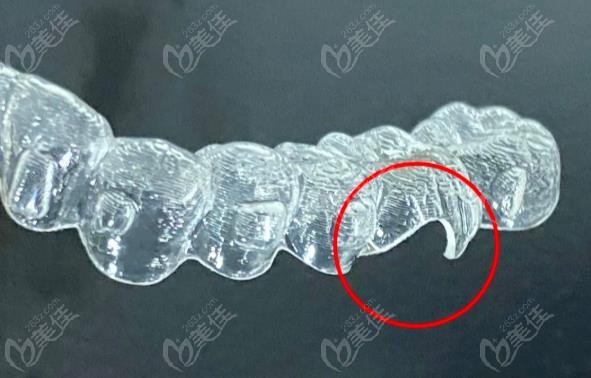 隐形牙套挂皮筋位置