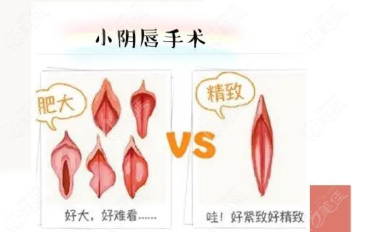 苏州女性私密整形费用多少钱