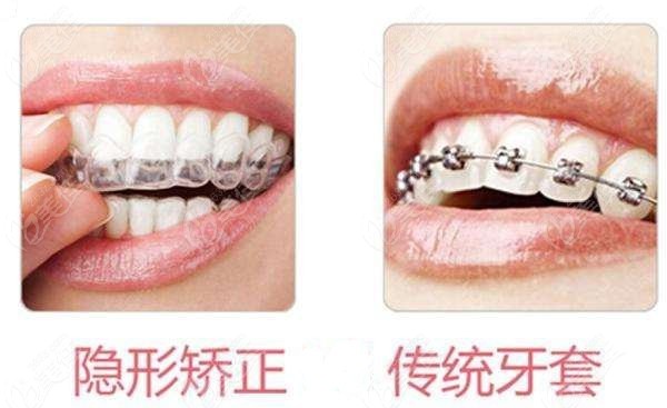<!--<i data=20240703-sp></i>-->齿科牙齿矫正收费标准