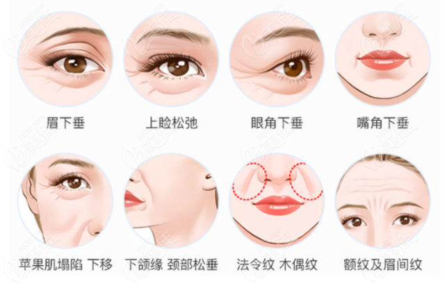 超声炮适合改善部位有哪些