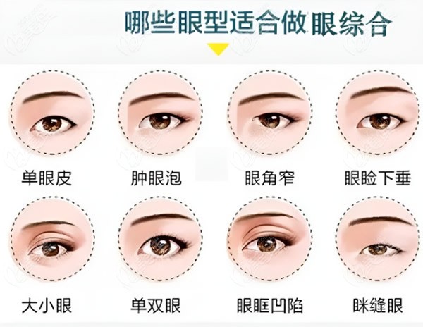 上海九慕整形眼综合做的怎么样