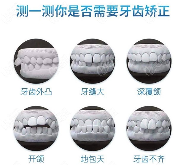 上海九慕牙齿矫正怎么样