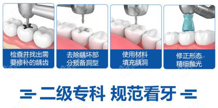 宣城大医口腔补牙多少钱