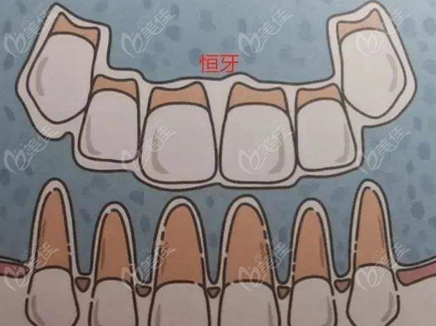 儿童乳牙和恒牙生长示意图
