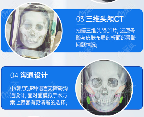 重庆时光下颌角磨骨设备优势