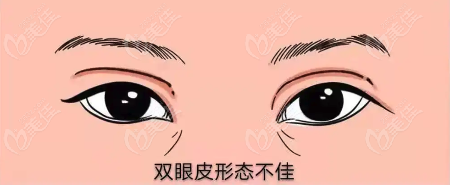 中国很难预约十大双眼皮修复医生是谁