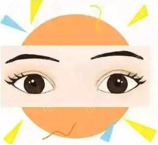 雙眼皮失敗修復標準