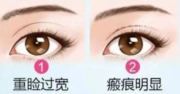 武汉<!--<i data=20240703-sp></i>--><!--<i data=20240703-sp></i>-->医生修复双眼皮 武汉<!--<i data=20240703-sp></i>--><!--<i data=20240703-sp></i>-->医生修复双眼皮