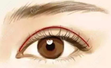 武汉<!--<i data=20240703-sp></i>--><!--<i data=20240703-sp></i>-->医生双眼皮术后 武汉<!--<i data=20240703-sp></i>--><!--<i data=20240703-sp></i>-->医生双眼皮术后