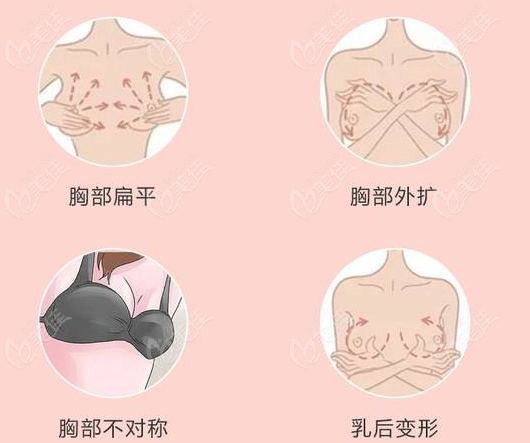 丰胸手术价格一览表15000起