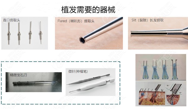 植发价格为什么那么贵啊