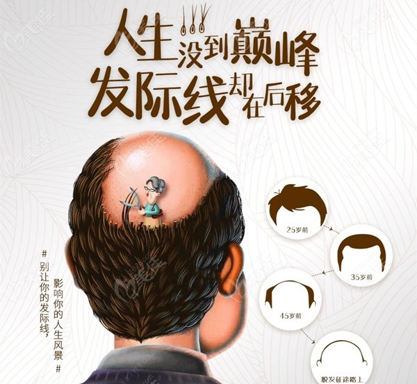 植发的价格会不会越来越便宜呢