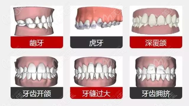 侯马王琳牙科诊所诊疗项目