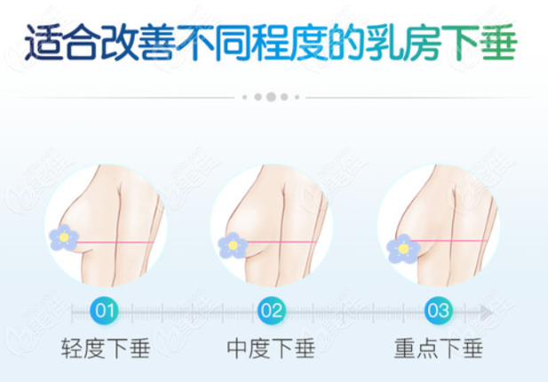 成都乳房下垂矫正医生排名