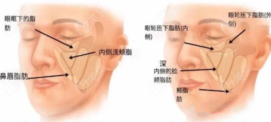 魔法超拉皮技术操作原理