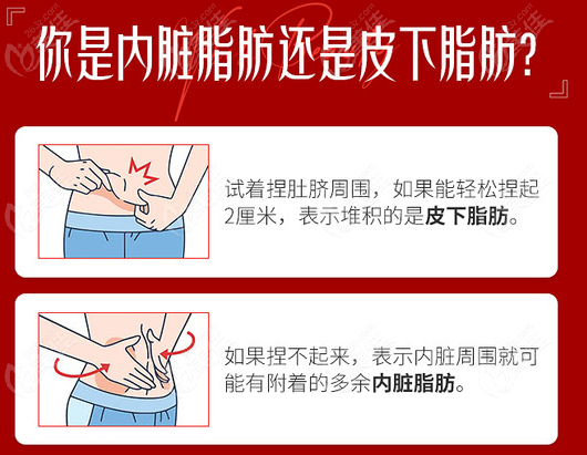 昆明吴氏嘉美教你自测！你属于哪种脂肪