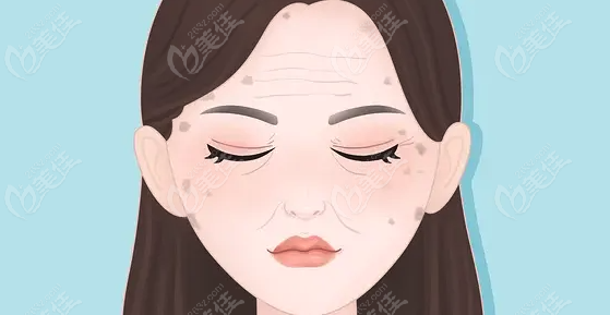 V美减龄面部提升是真是假