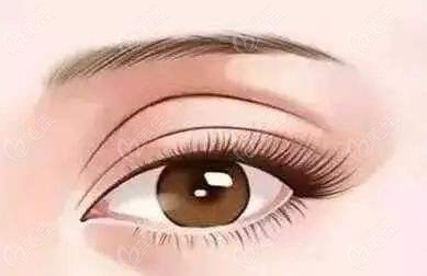 眼综合年轻化可以改善眼周衰老