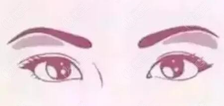 骨不对称改善方式