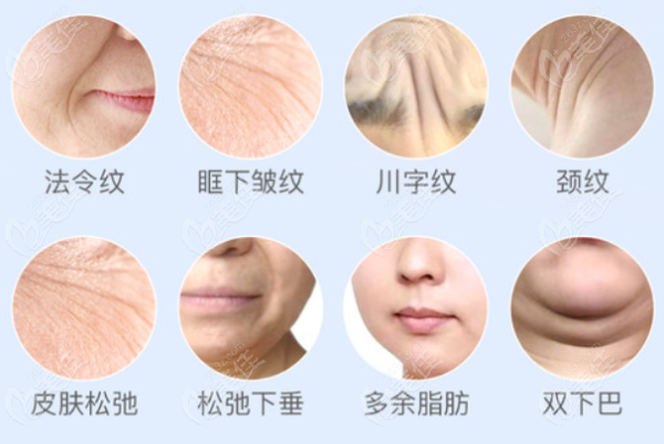 超声炮适合的部位有哪些