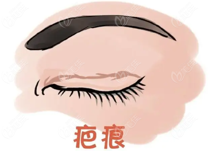 鄭州邵志明修復(fù)雙眼皮怎么樣