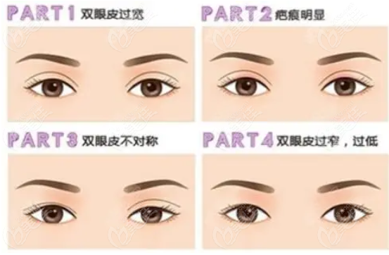 邵志明雙眼皮修復(fù)價(jià)格www.pfflawyer.com