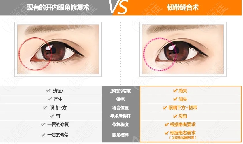 开眼角失败后的修复方法
