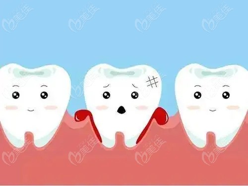 洗牙牙龈萎缩能恢复么