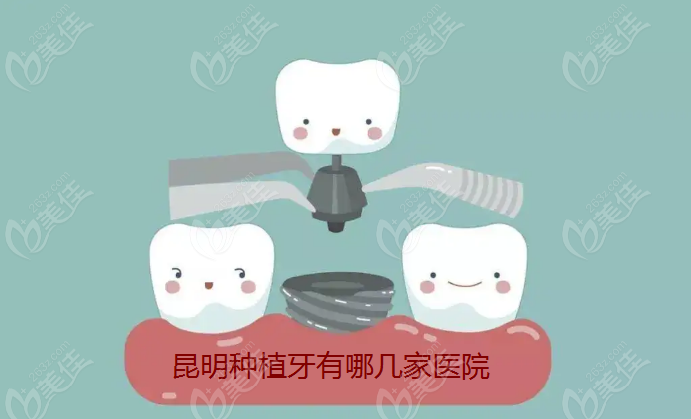 昆明种植牙好的医院排名