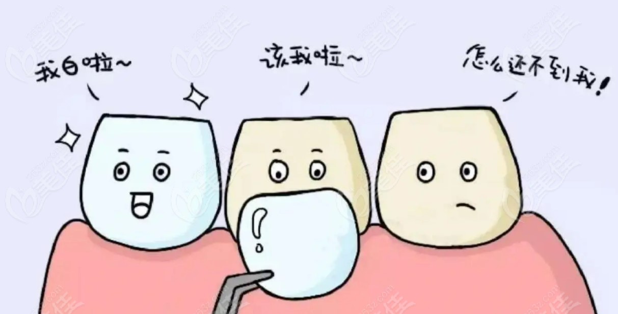 昆明做牙贴面哪家好