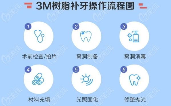 3M树脂补牙流程