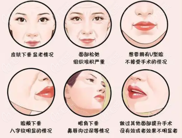 面部除皺手術部位