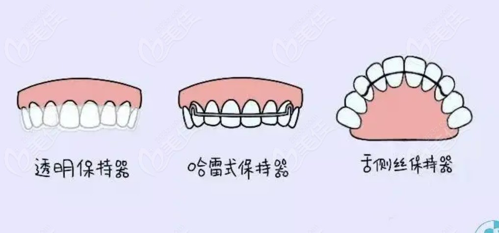 北京矫正牙齿需要多少钱
