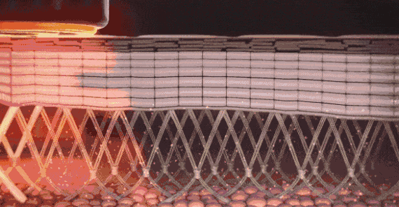 fb308d1665c3ba4553d4ae58072267c7_640_wx_fmt=gif&wxfrom=5&wx_lazy=1.gif