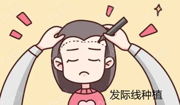 杭州正规植发机构收费标准