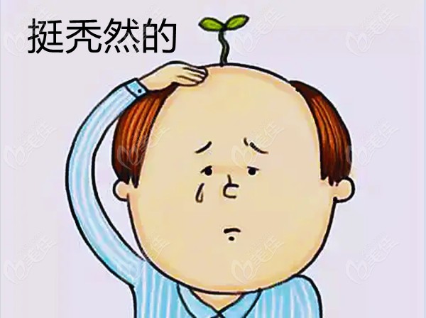 杭州秃顶植发多少钱