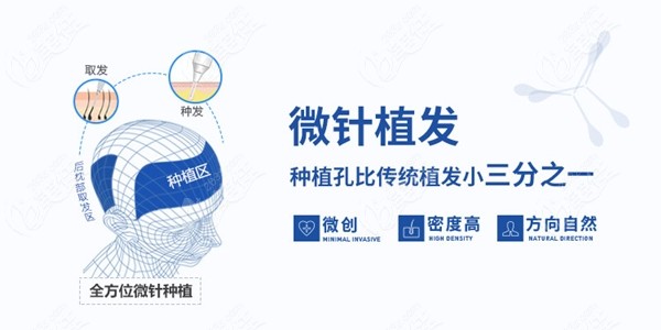 杭州正规植发机构收费标准
