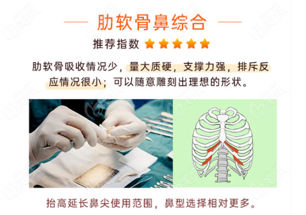 成都肋骨鼻综合哪些医生做得好