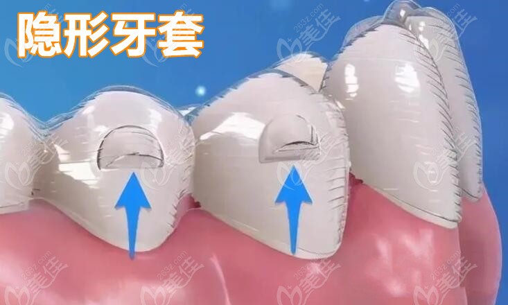 沈阳国颂口腔牙齿矫正价格合理