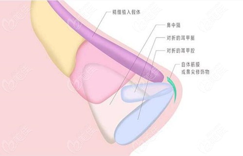 大庆超龙鼻修复技术图