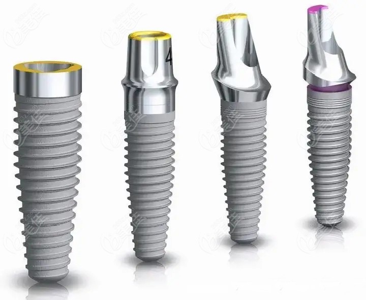 诺贝尔种植体三种档次价格