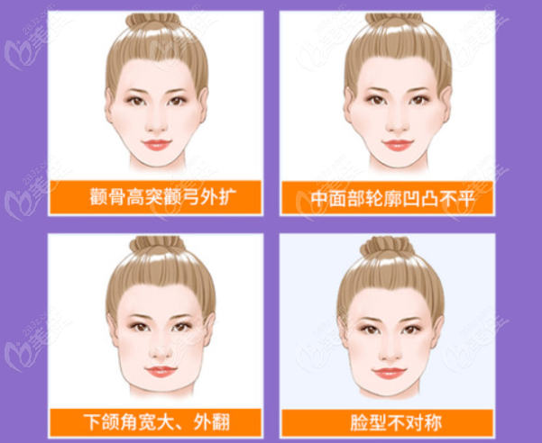 成都磨骨修复哪家医院好