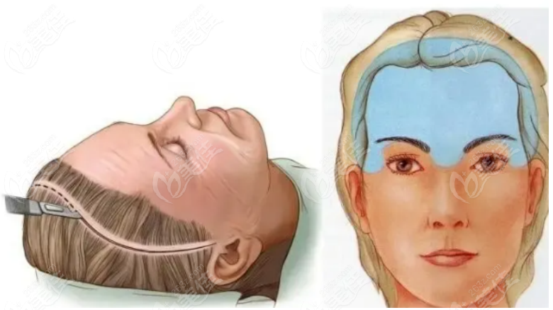 劉小剛醫(yī)生