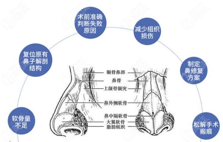 成都铜雀台整形周柯医生鼻修复技术怎么样 成都铜雀台整形周柯医生鼻修复技术怎么样