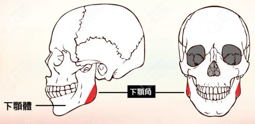 重庆松山医院整形科做面部轮廓手术多少钱？双11松山医院面部轮廓三件套28811元起