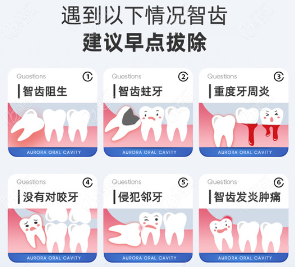 赣州拔智齿去什么医院比较好